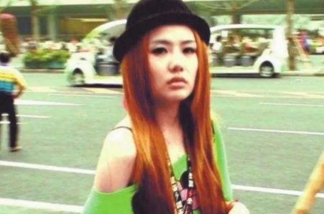 "整容失败"王贝:和母亲一起走上手术台,出事后家人却选择私了