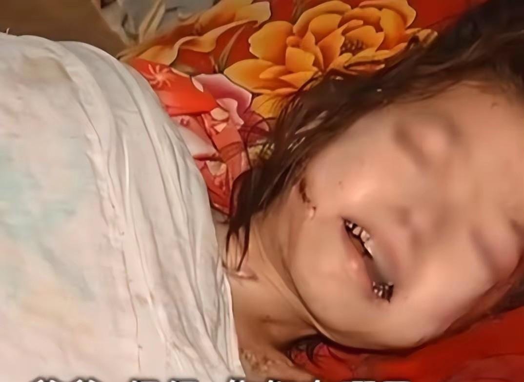 十岁女孩全身溃烂长蛆,盼见父母,父亲却狠心说死扔出去,可恶