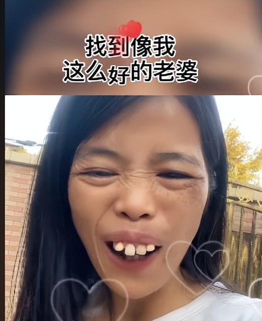 梅梅:靠"卖丑"出圈,圈粉百万成网红,龅牙被网友质疑是假牙