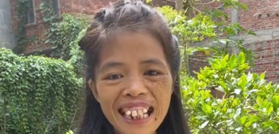 梅梅:靠"卖丑"出圈,圈粉百万成网红,龅牙被网友质疑是假牙