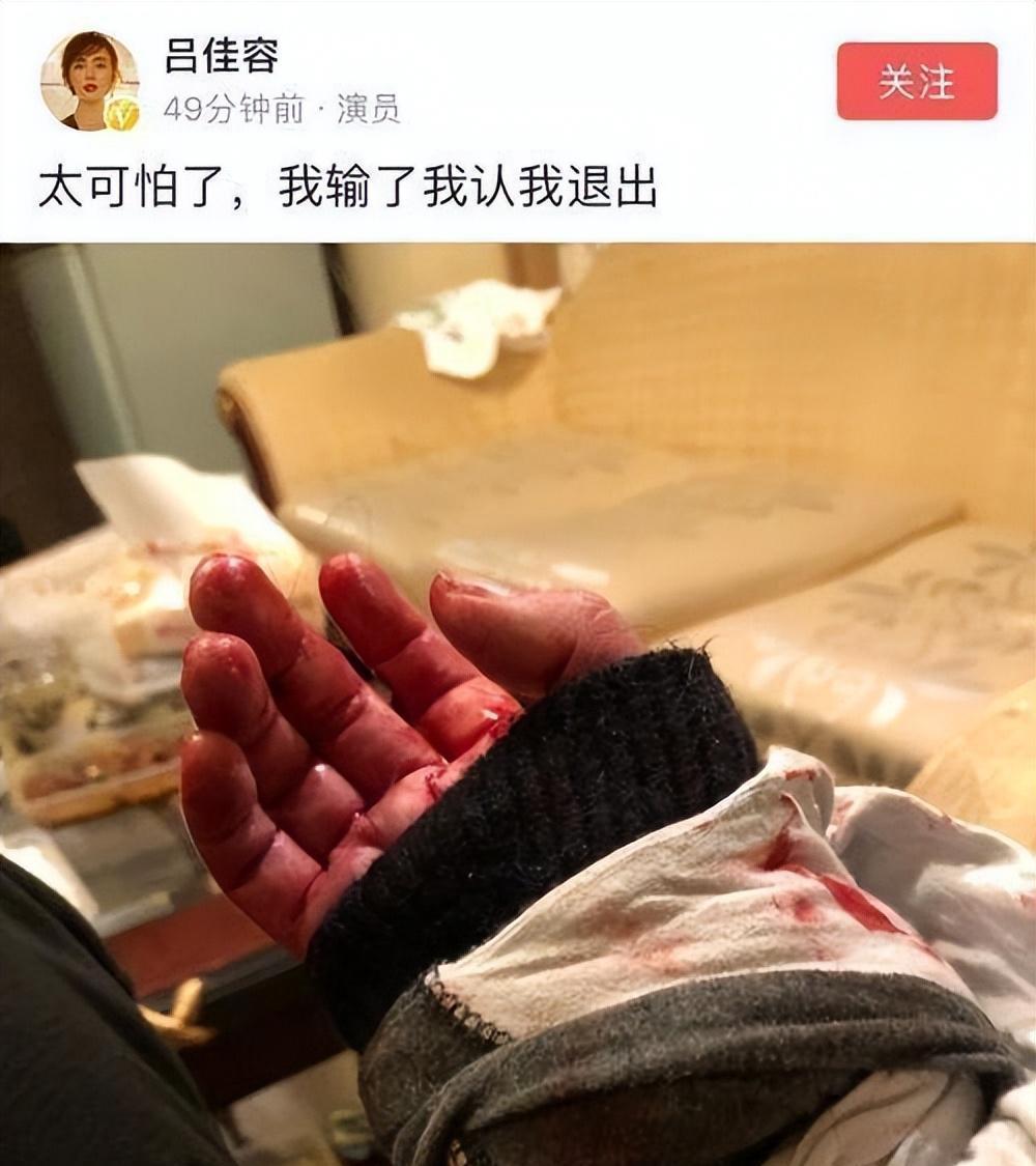 传演员吕佳容出事!曾晒割腕照,称:我出事的话就是和乔任梁一样