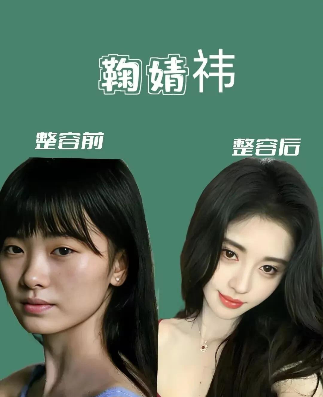 我心目中最成功的女明星整容案例,你们怎么看?