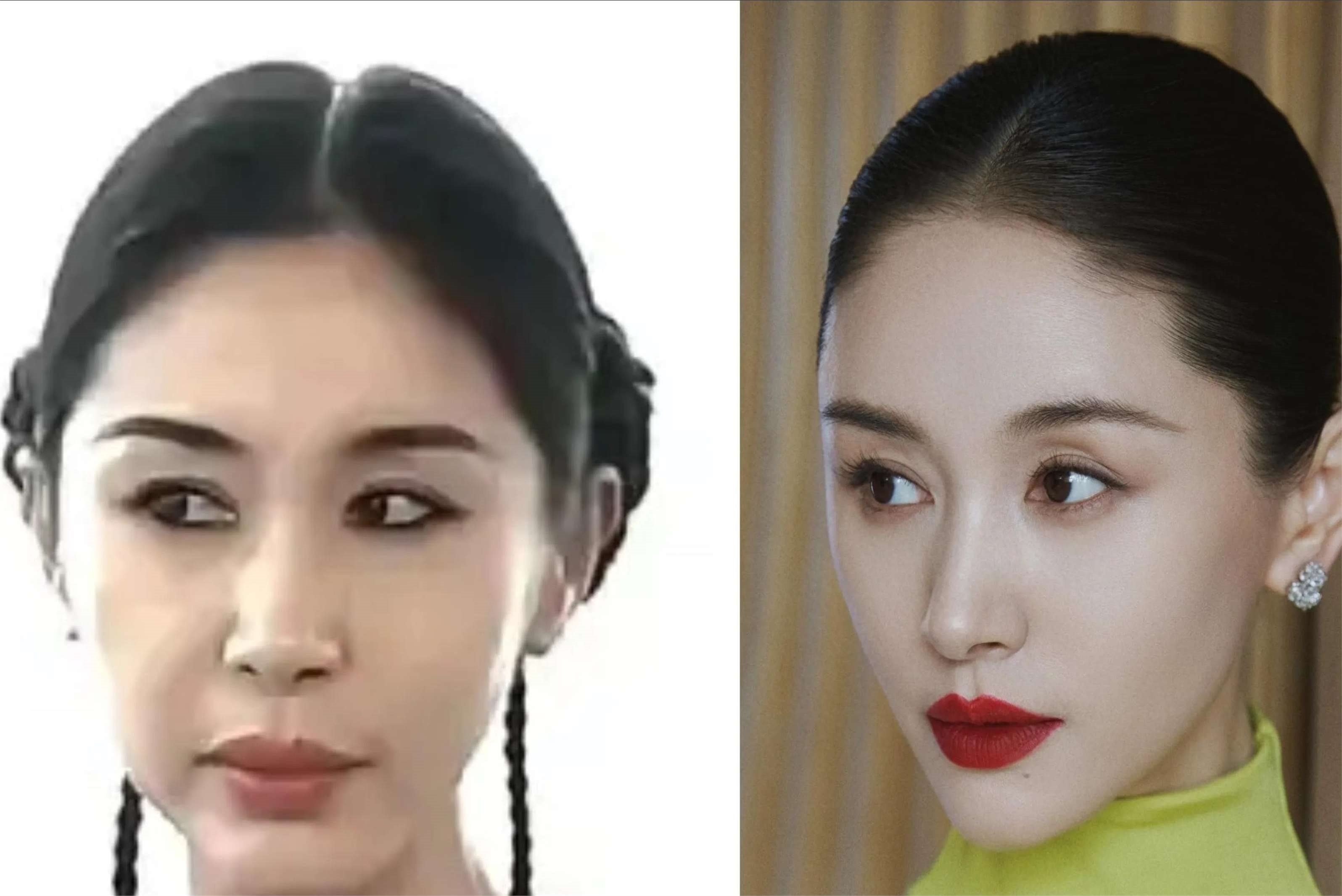 37岁王子文变化大!脸部有些圆润不敢认,网友犀利:医美后遗症