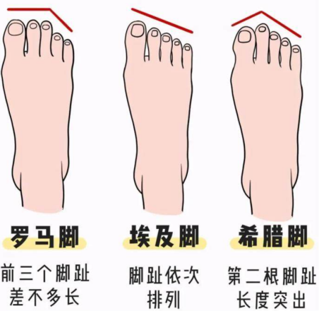 人的脚型主要分为这三类