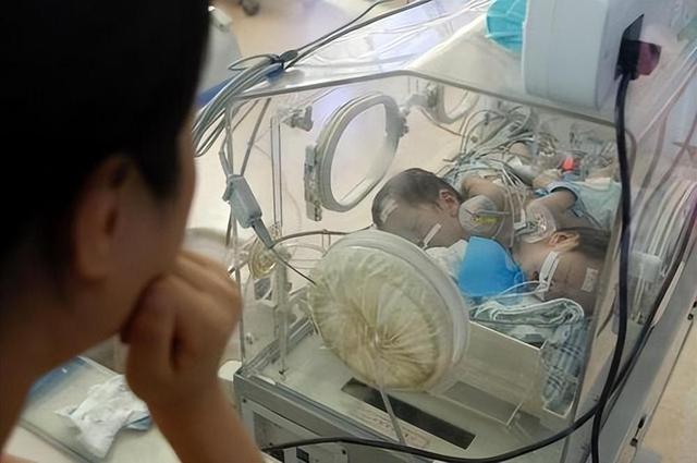 2011年,四川女子生下中国首例双头婴儿,之后怎么样了