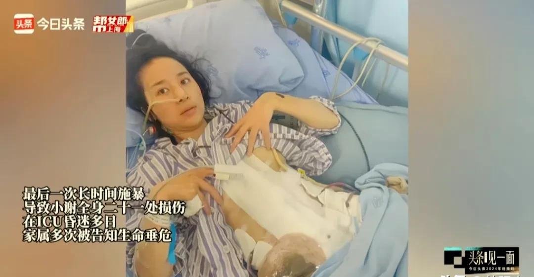 报警没用?两年被家暴十六次受害人小谢哭诉:希望我是最后一个人