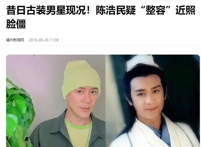 陈浩民面容僵硬引热议!龚慈恩整容失败,古天乐颜值争议不断
