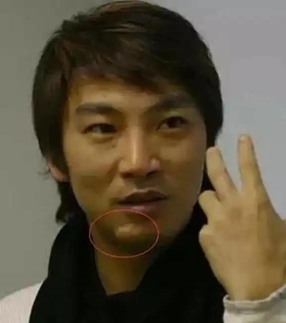 春晚一曲成名,后遭重创失去下巴,如今靠卖马桶生活的他过得怎样