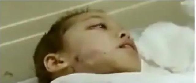 08年10岁女孩全身溃烂长蛆,临终想见父母一面,父:死了就扔出去