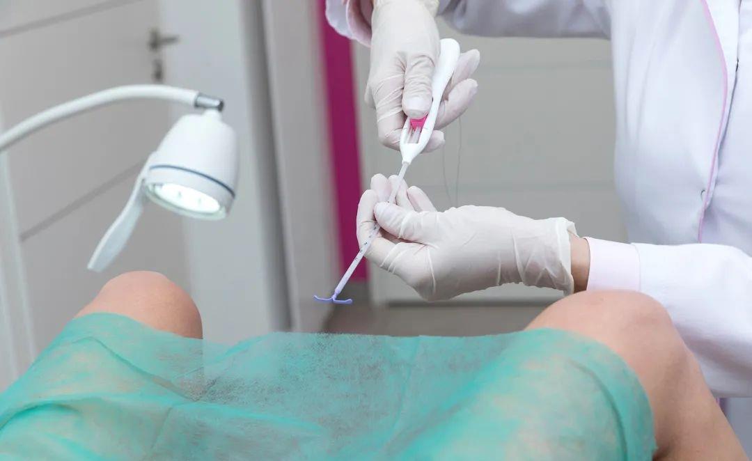 女性上环全过程,令人心痛!男女皆应关注,珍惜身边的人