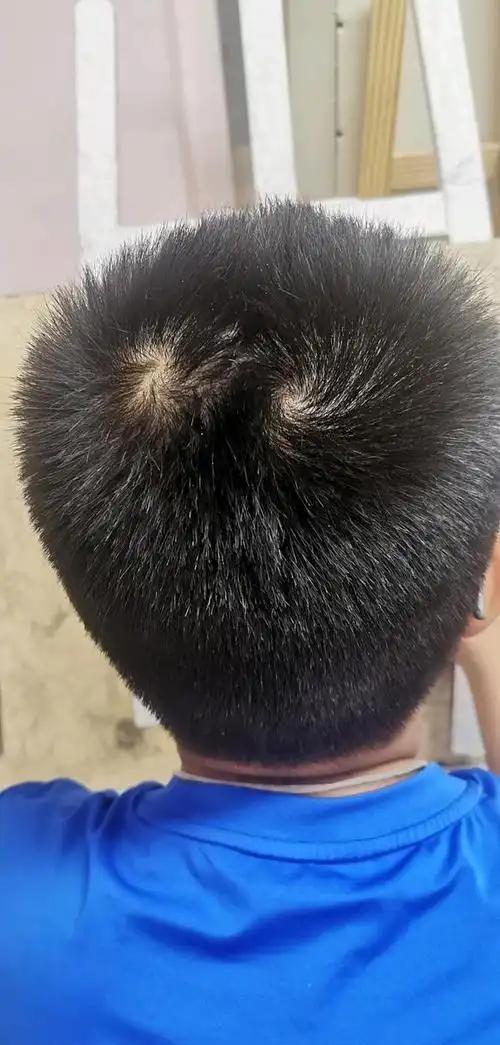 孩子头顶"两个旋",到底代表什么?很多父母不懂,看完涨知识