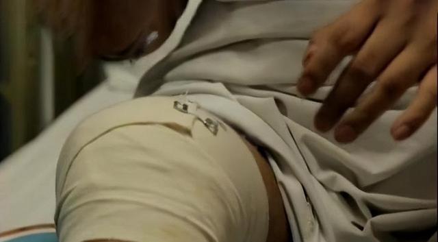 2016年,男子腿部中弹,深夜求医后,医生的一番话,让他立即报警