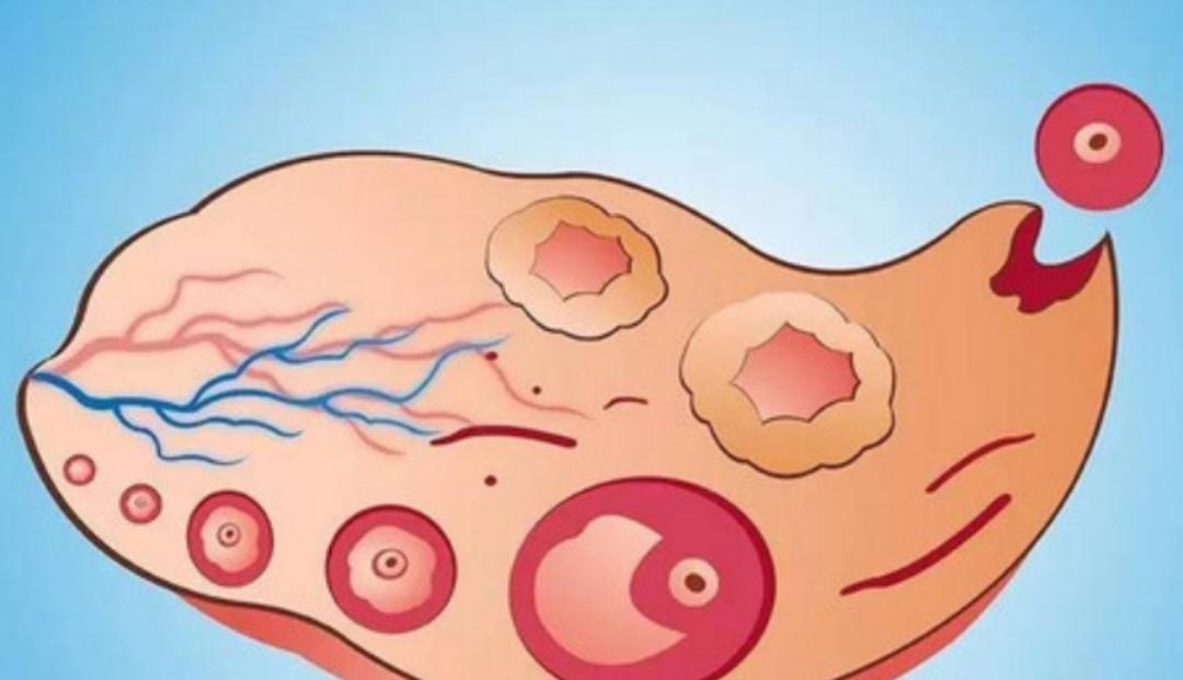 排卵时身体有感觉吗?这些变化对避孕备孕很关键