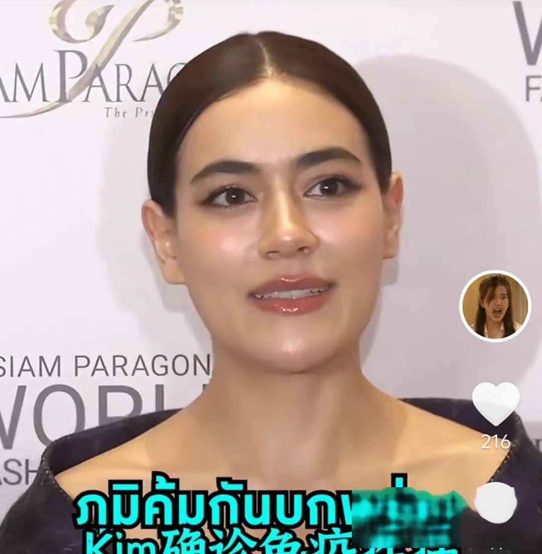 不得了!泰星kim患免疫病需周周打针,生子计划被搁置