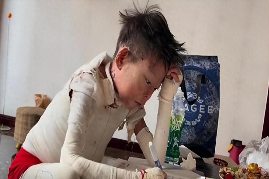 12岁"蝴蝶宝贝"坚强求生路引全网泪目