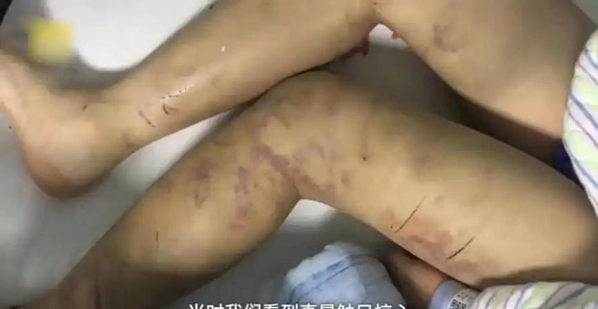 最新消息!5岁男孩被害案开庭:生母狠毒手法曝光,父亲含泪发言