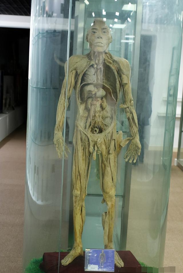 人体标本制作师:没有固定休息时间,每年处理50具遗体,全靠捐献