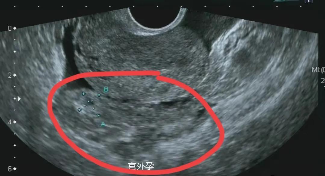 闹大了!实习医生将腹部超声看成阴超,患者感觉被辱,投诉要说法