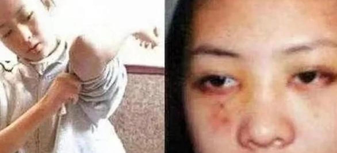 被张默当街殴打,嫁大17岁富商的童瑶,如今活成他高攀不起的样