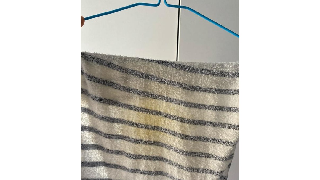 毛巾为什么会发黄