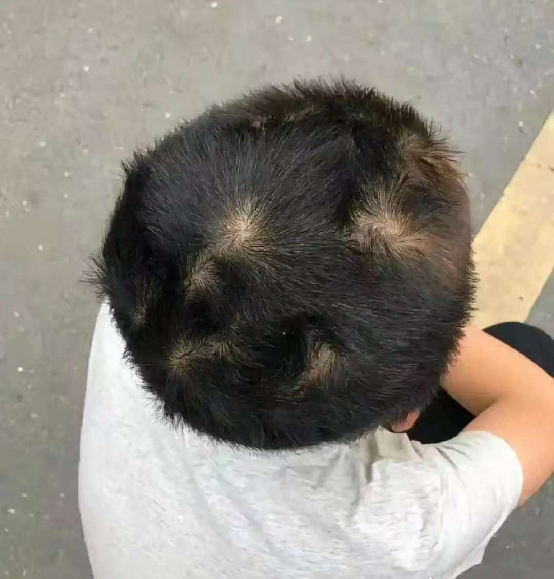 孩子头顶"两个旋",老祖宗说暗示这几种命运!很多父母都猜错了