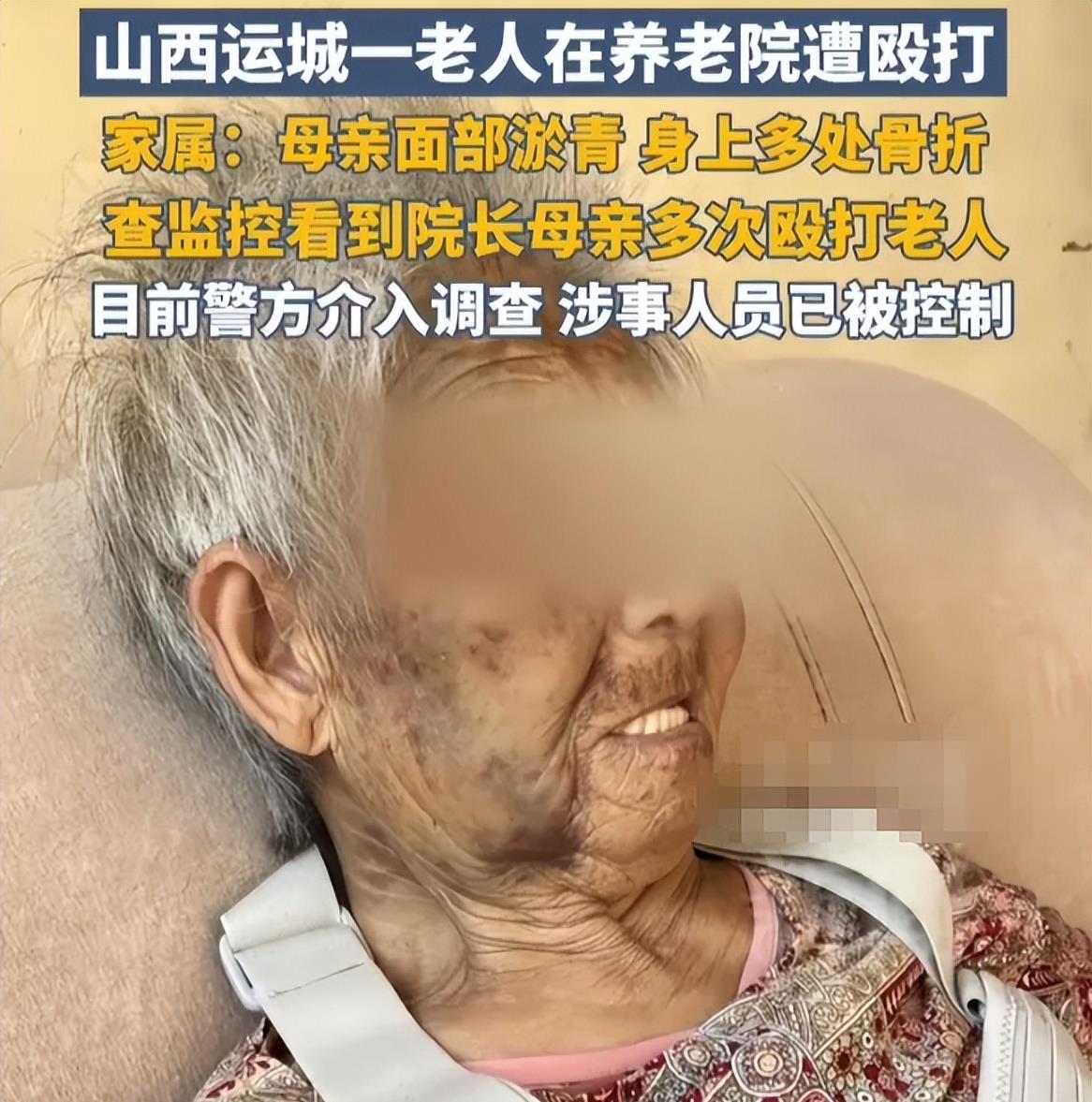 养老院管理者殴打老人引发社会谴责监控揭露恶行儿子也受牵连