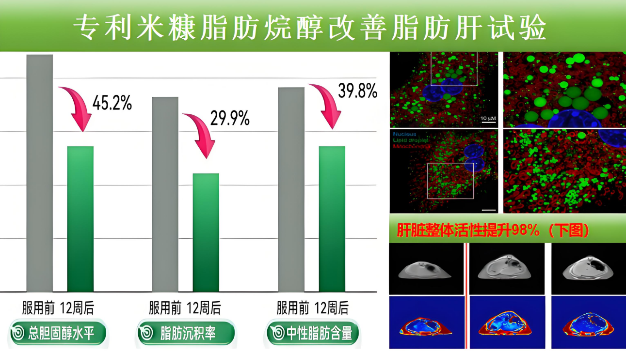 《自然》实证：8周清肝降损！“吉利肝”凭啥成全球脂肪肝患者的救星？