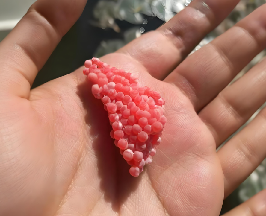 妻子发现丈夫身上有粉色虫卵,去医院检查后,医生:赶快报警