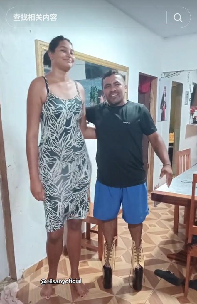 身高悬殊的巨人症女孩两米高,丈夫仅一米六,婚后照片风格大不同