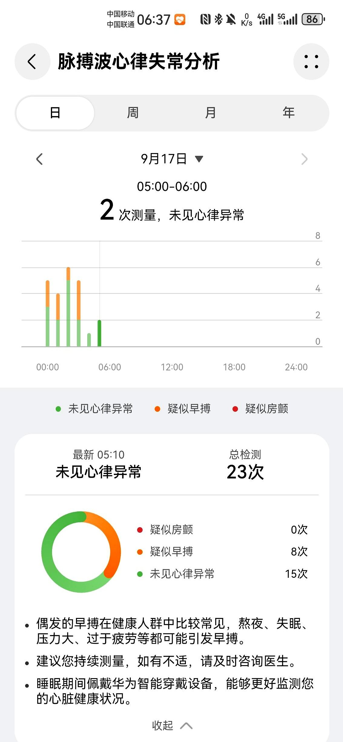 饭前吃胃药？房颤消融后，我的心脏重启了！医生说，还得防复发！