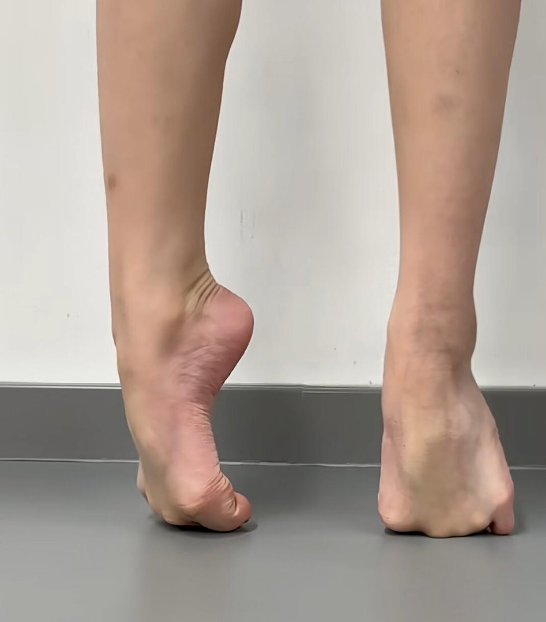 从没见过刘诗诗露过脚趾,看完这组照刹那明白了.舞蹈生的心酸!
