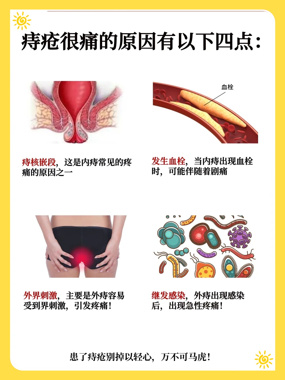 痔疮为什么疼