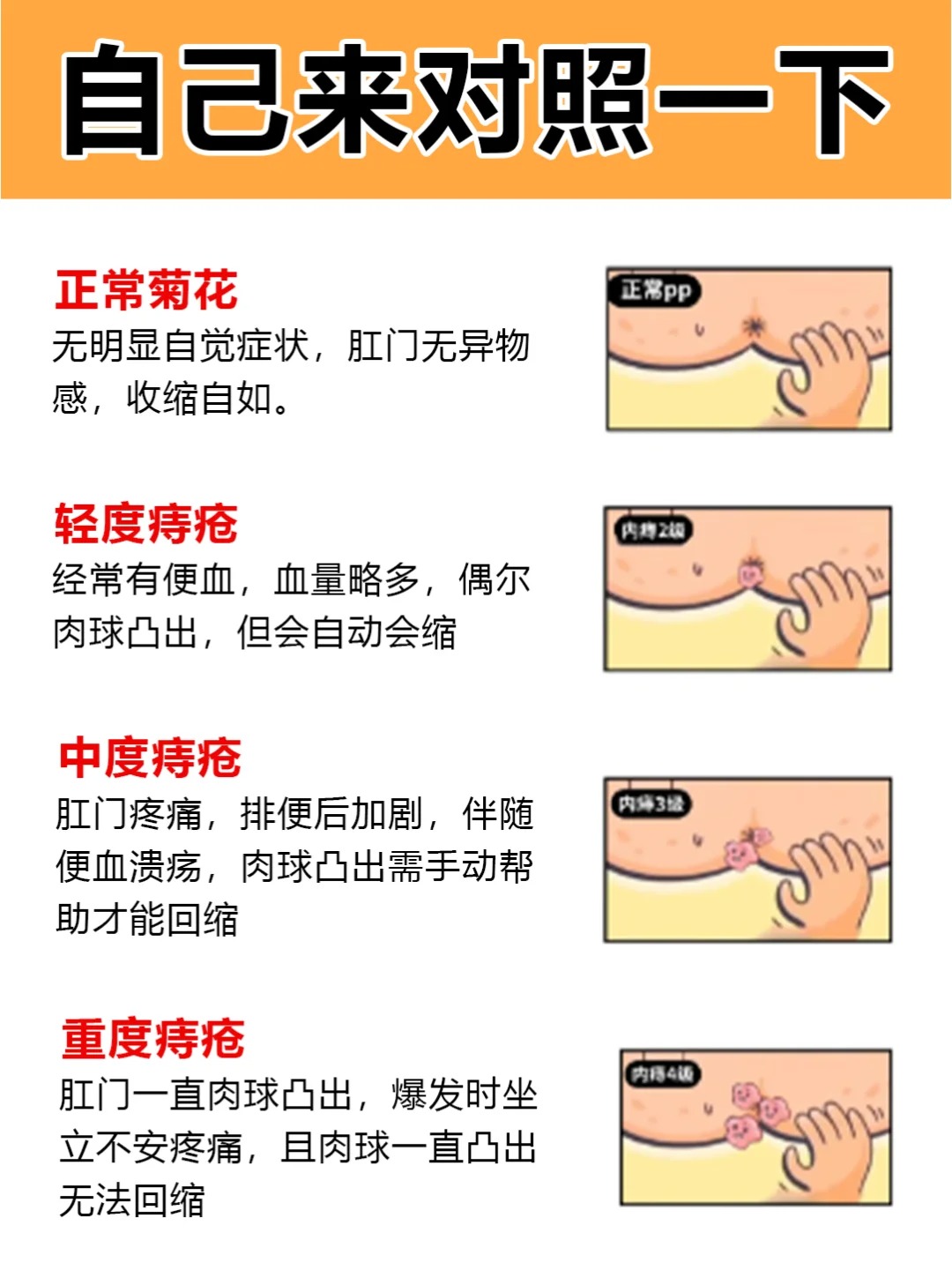 重度痔疮患者的6个改善动作!赶紧收藏!