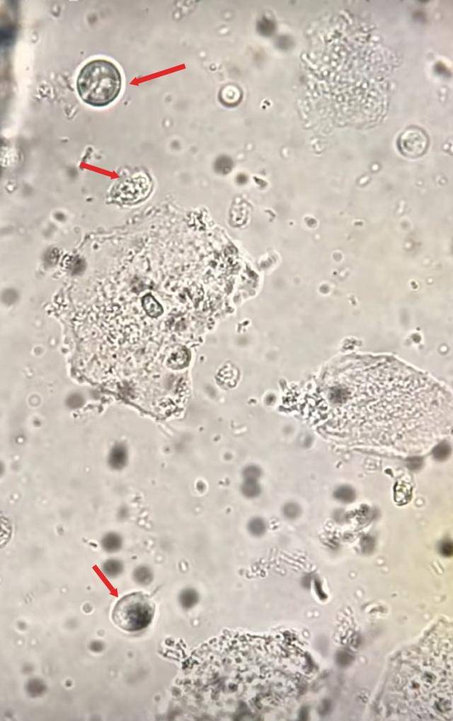 显微镜下的阴道毛滴虫与鞭毛特征