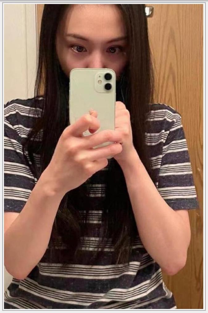 郑爽近照睡衣素颜接地气,脸部僵硬法令纹抢镜,曾经白月光如今普通人