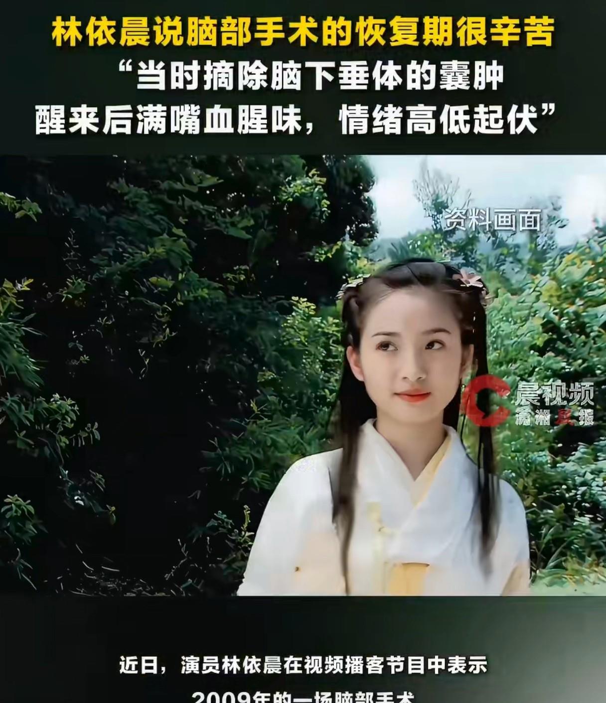 43岁林依晨接受手术自曝手术详情口中满是血腥味