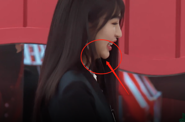 李菲儿脸僵"香肠嘴",下巴肿胀感明显,网友:难怪火不起来