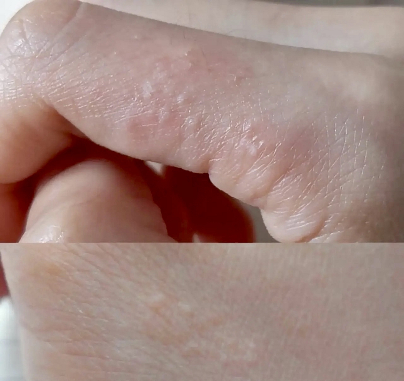 我一听,说"我手上也有!"  "每年都是这个时候起,其他时间没有.