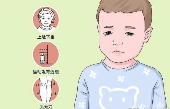 什么是杜氏肌营养不良?会有哪些症状表现?