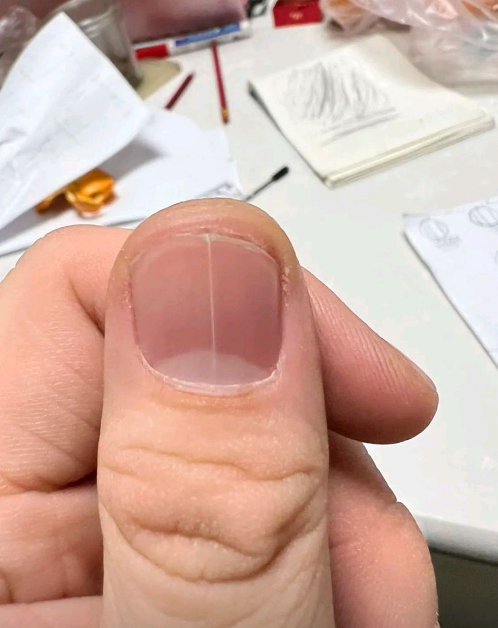 网友:指甲长条白线还裂开是什么问题?