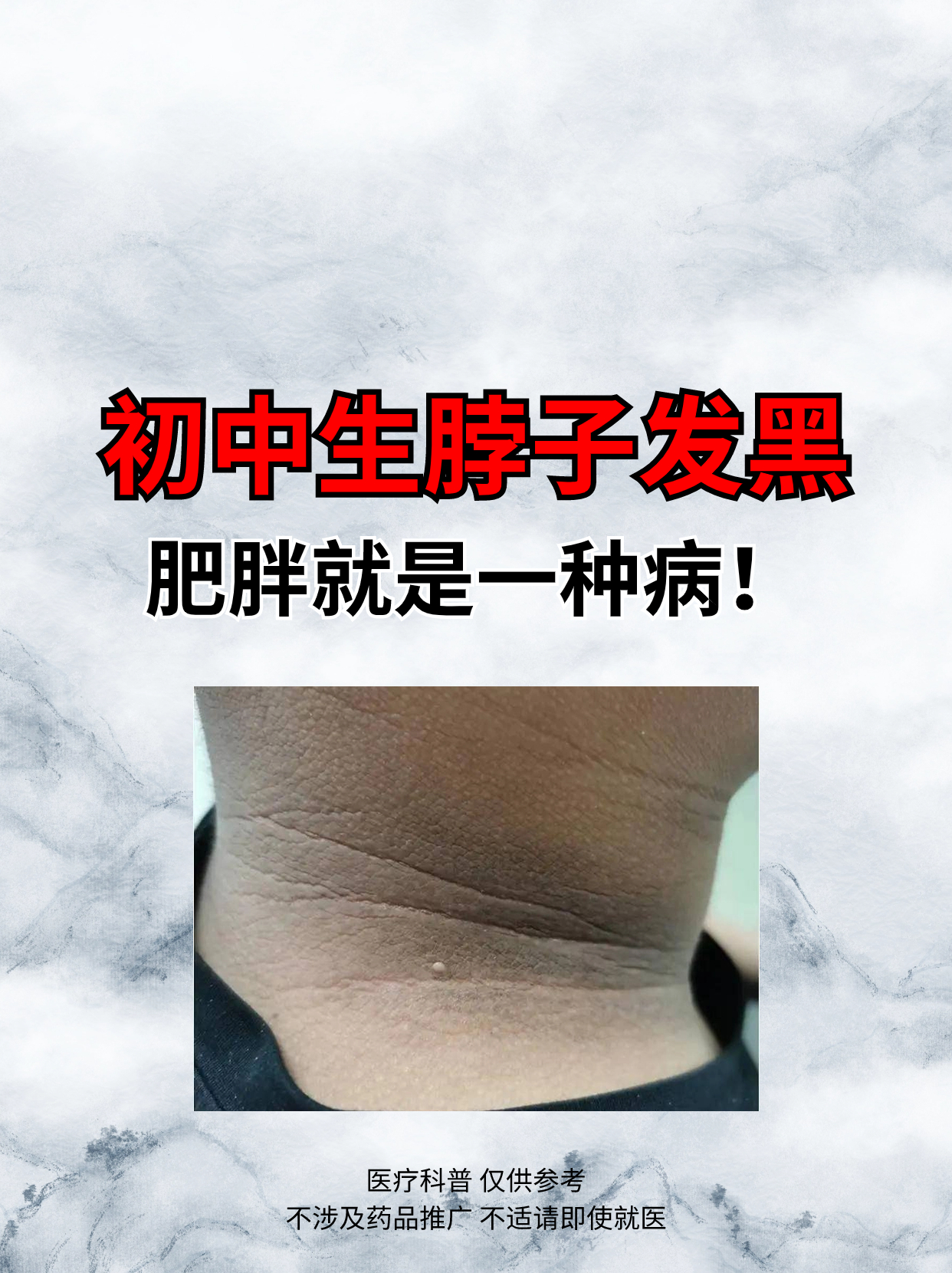 女性脖子皮肤发黑原因引起的