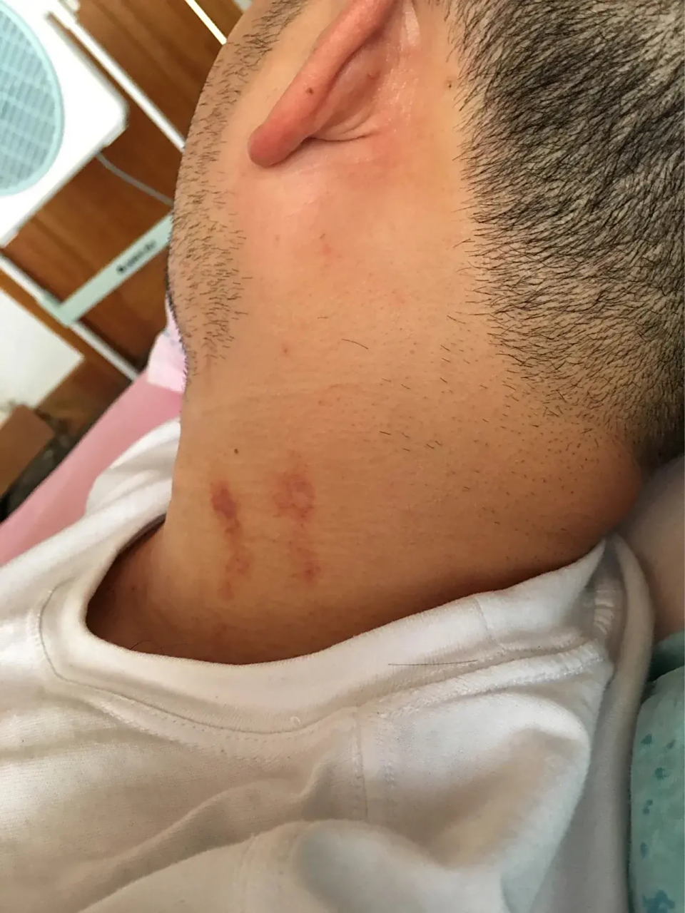 老公说是别人捏的,我说是草莓印  我最好的朋友告诉我,那个女人很可能