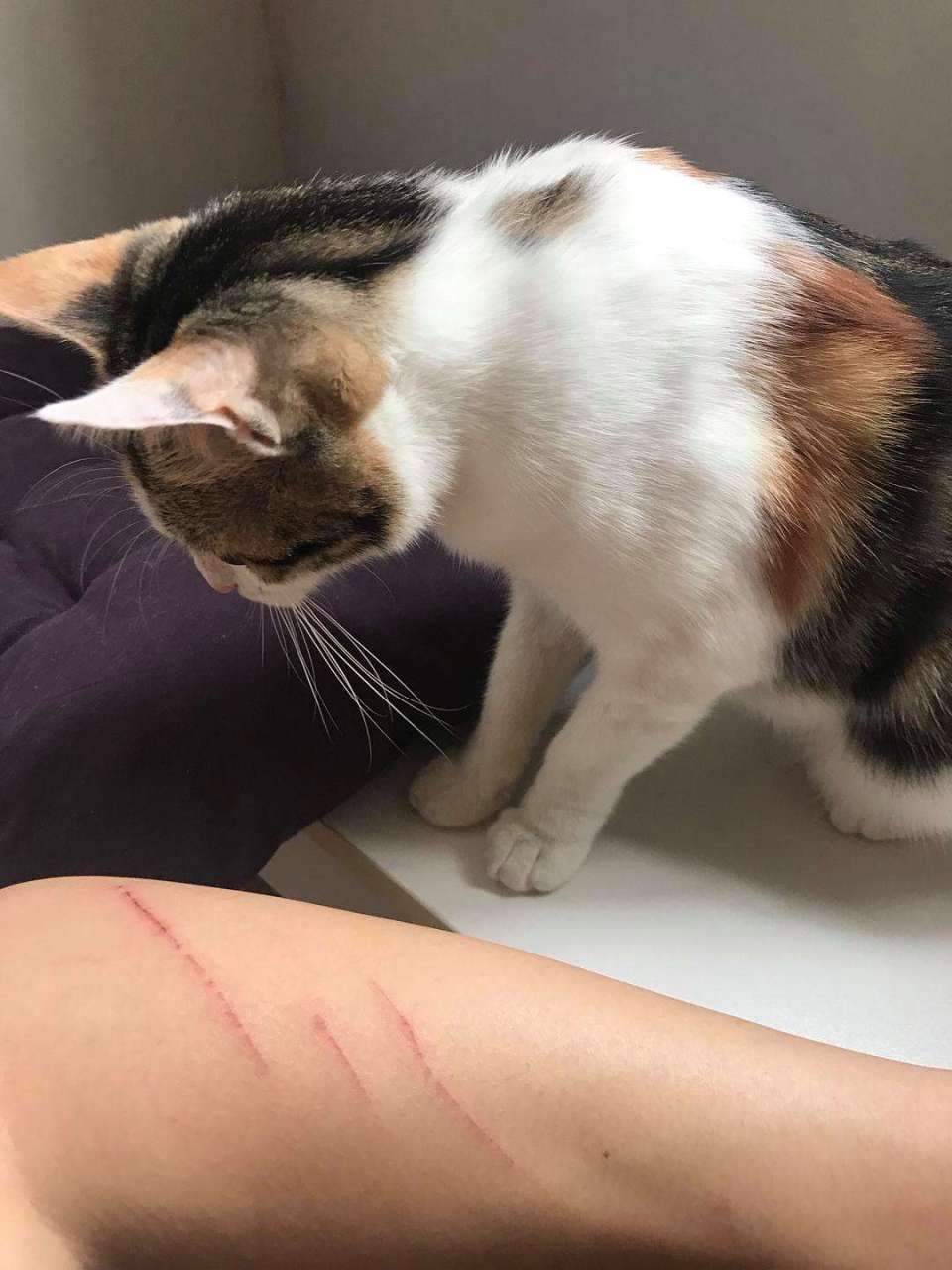 9岁女孩被猫抓伤高烧14天  6月14日,陕西西安,一9岁女孩突然发高烧到