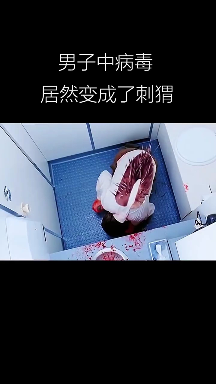 男子中了病毒居然变成了刺猬