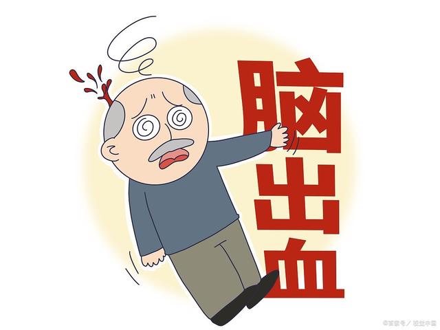 脑溢血的前兆