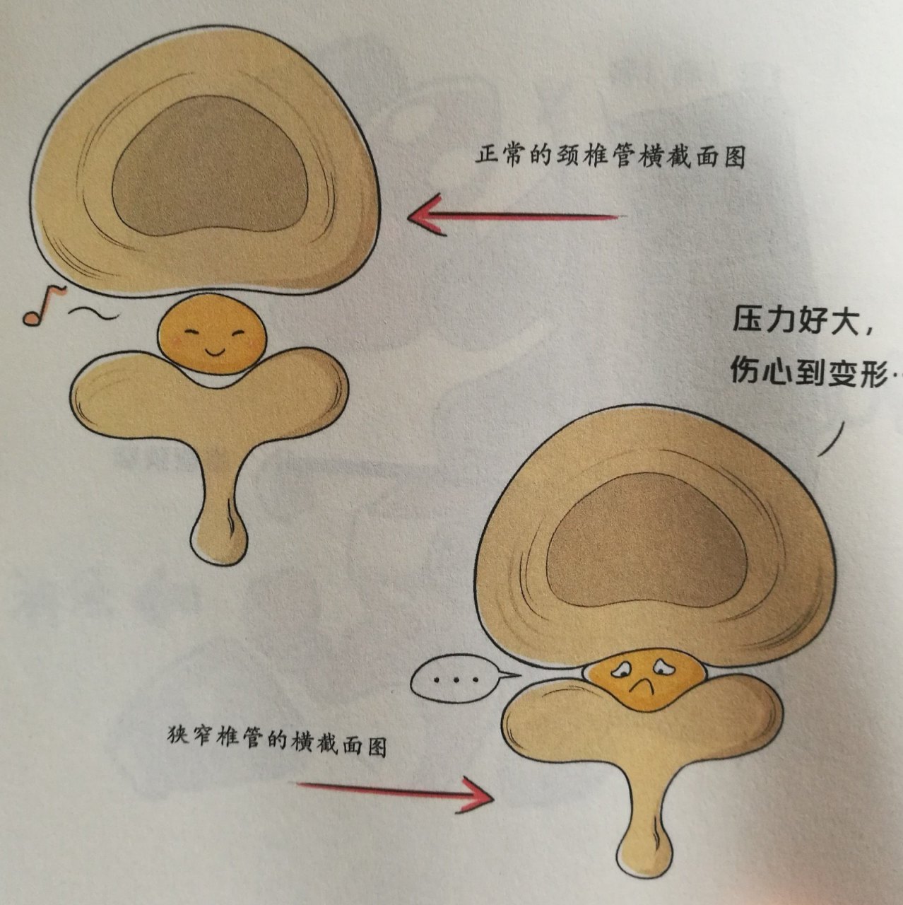 三个腰椎管狭窄的表现,您知道几个?