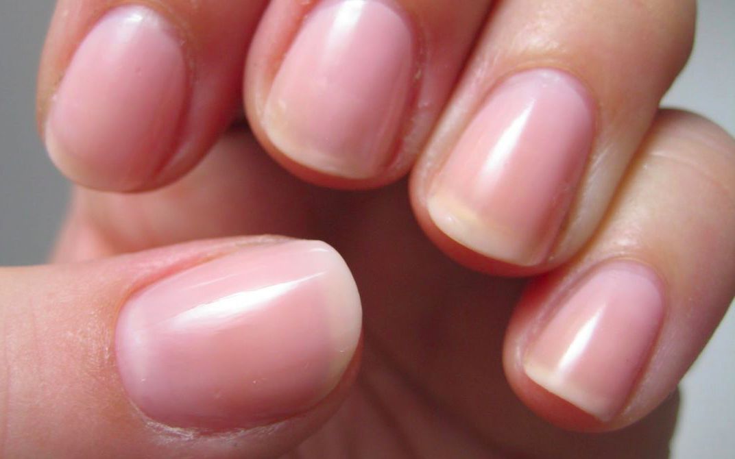 为什么有的人指甲上有月牙,有的人却没有?看完涨知识了