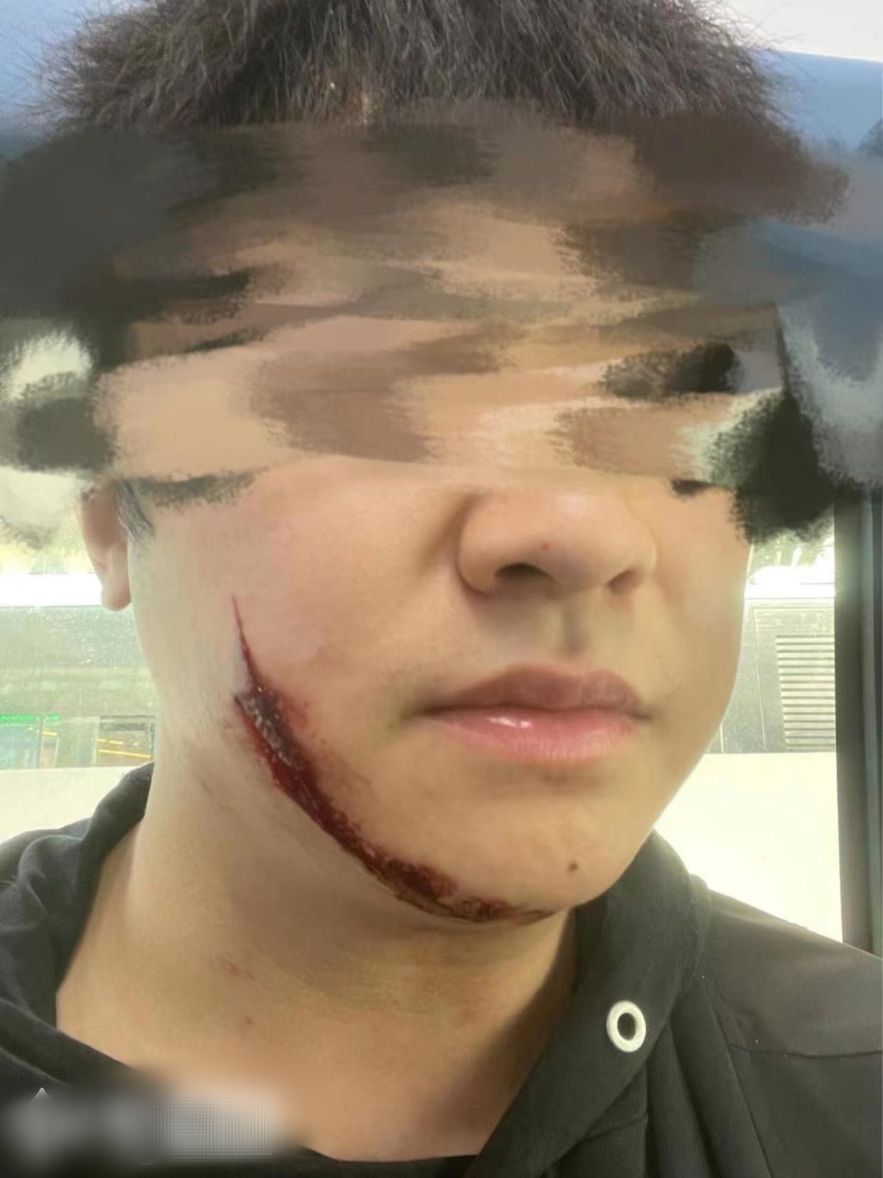 农业执法人员持刀伤人 仍正常上班