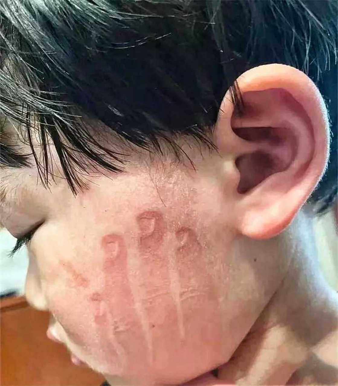 看到孩子脸上的手掌印,要不要找班主任?
