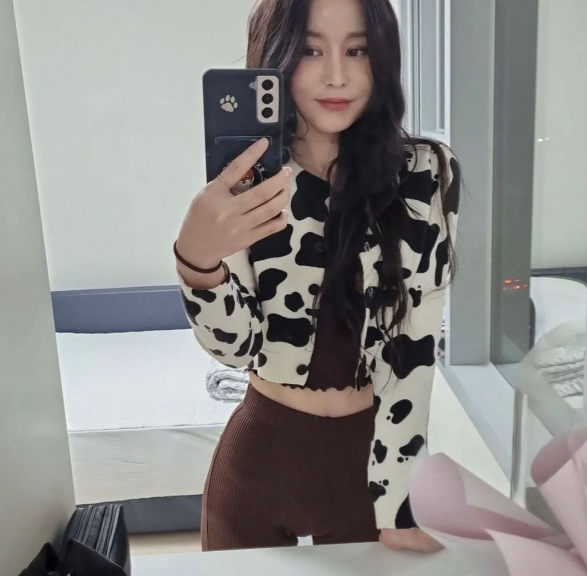 最美脱北者朴研美近况曝光!厚唇,僵硬五官认不出,网民:整容上瘾